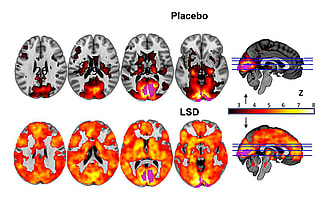LSD brain scan Imperial beckley foundation