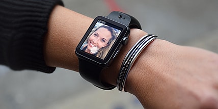 The CMRA band adds two cameras to Apple Watch (Photo: Glide)