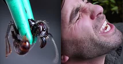 ant sting
