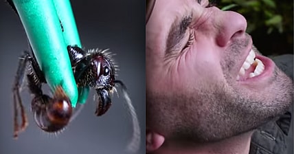 ant sting