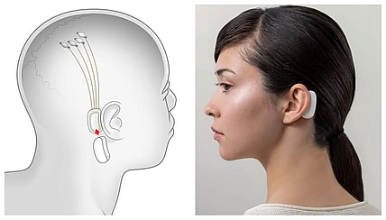 neuralink-musk