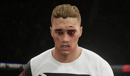 bieber-bloodied.jpg