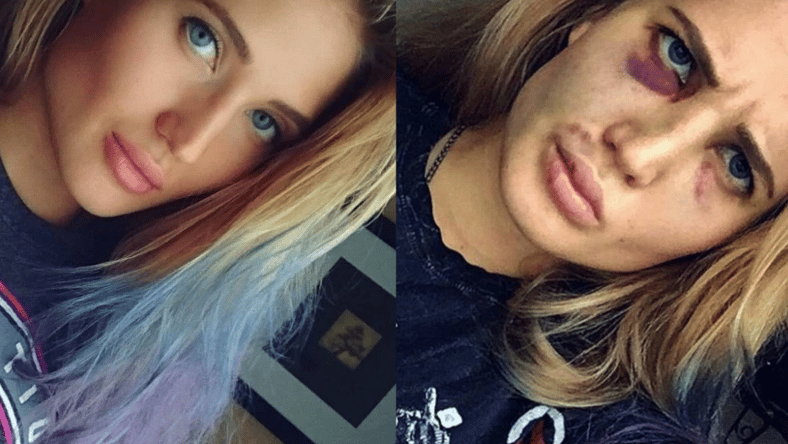 anastasia yankova before after