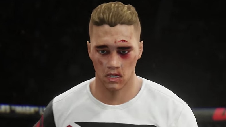 bieber-bloodied.jpg