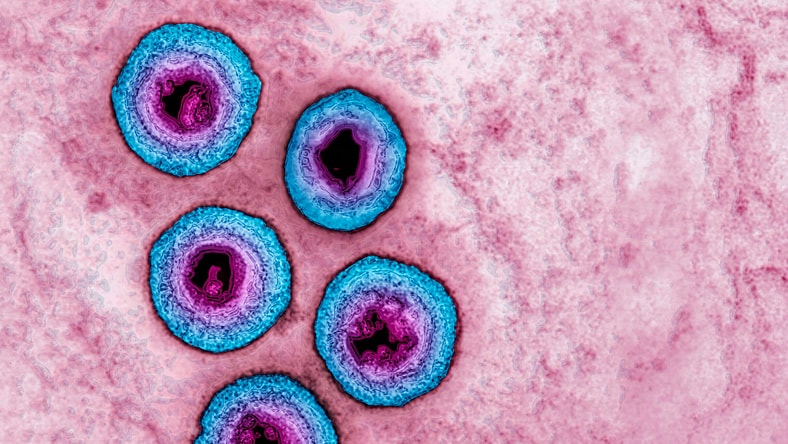 herpes-simplex.jpg