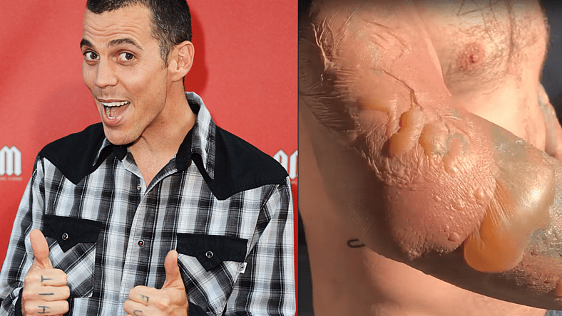 Steve O Burn