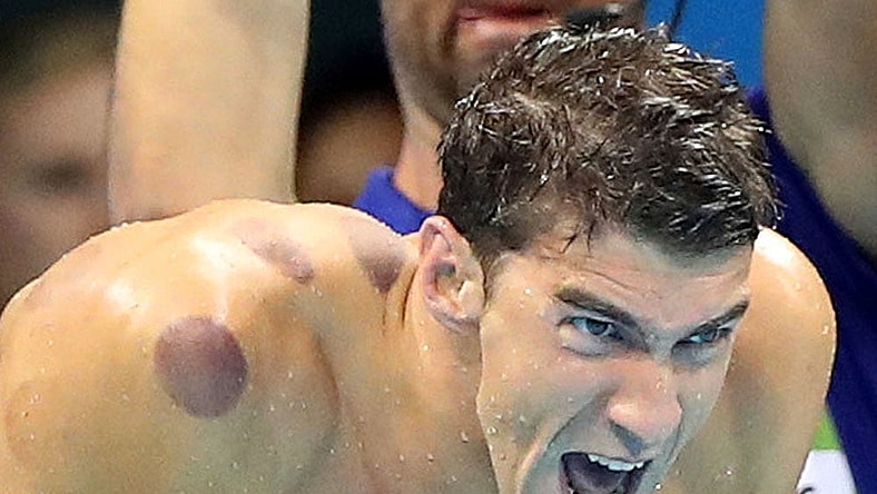 Michael Phelps AP cupping