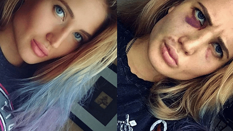 anastasia yankova before after