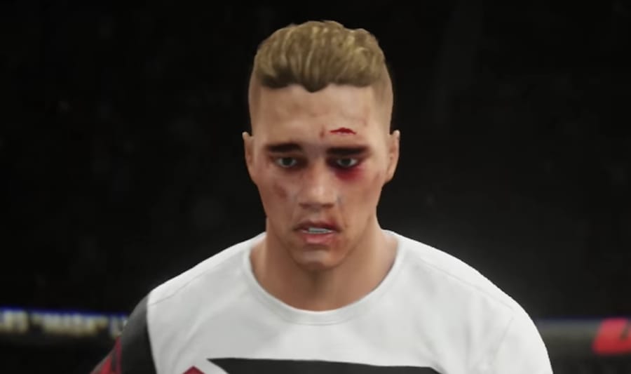 bieber-bloodied.jpg