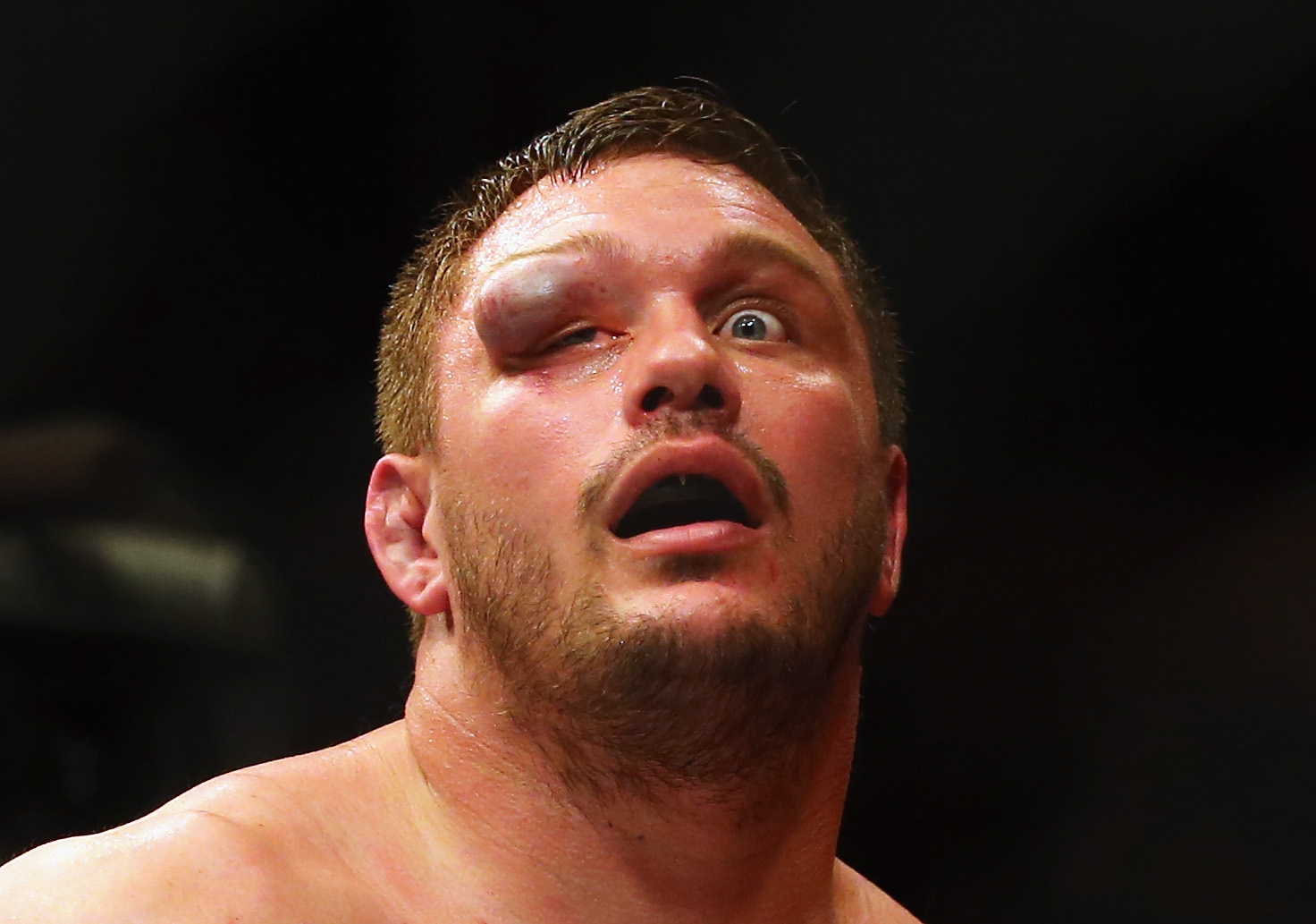 matt mitrione