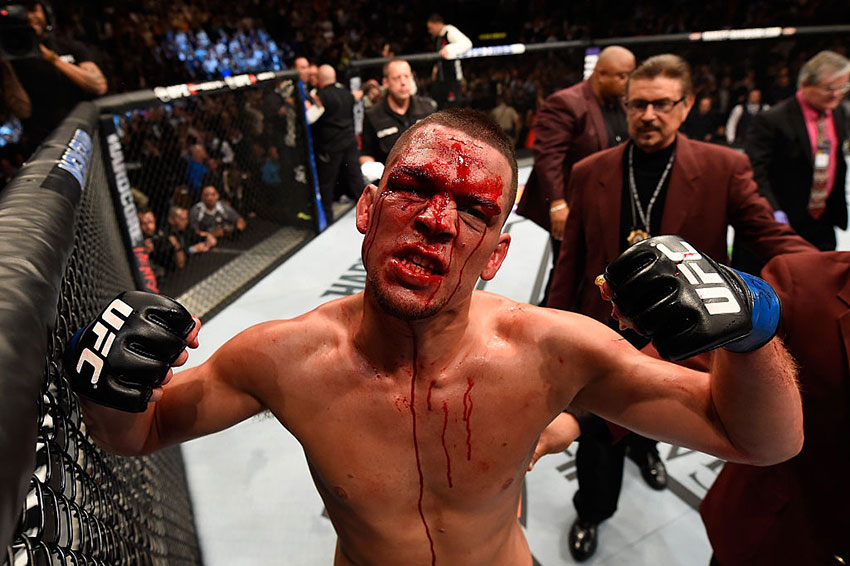 Nate Diaz Getty Images