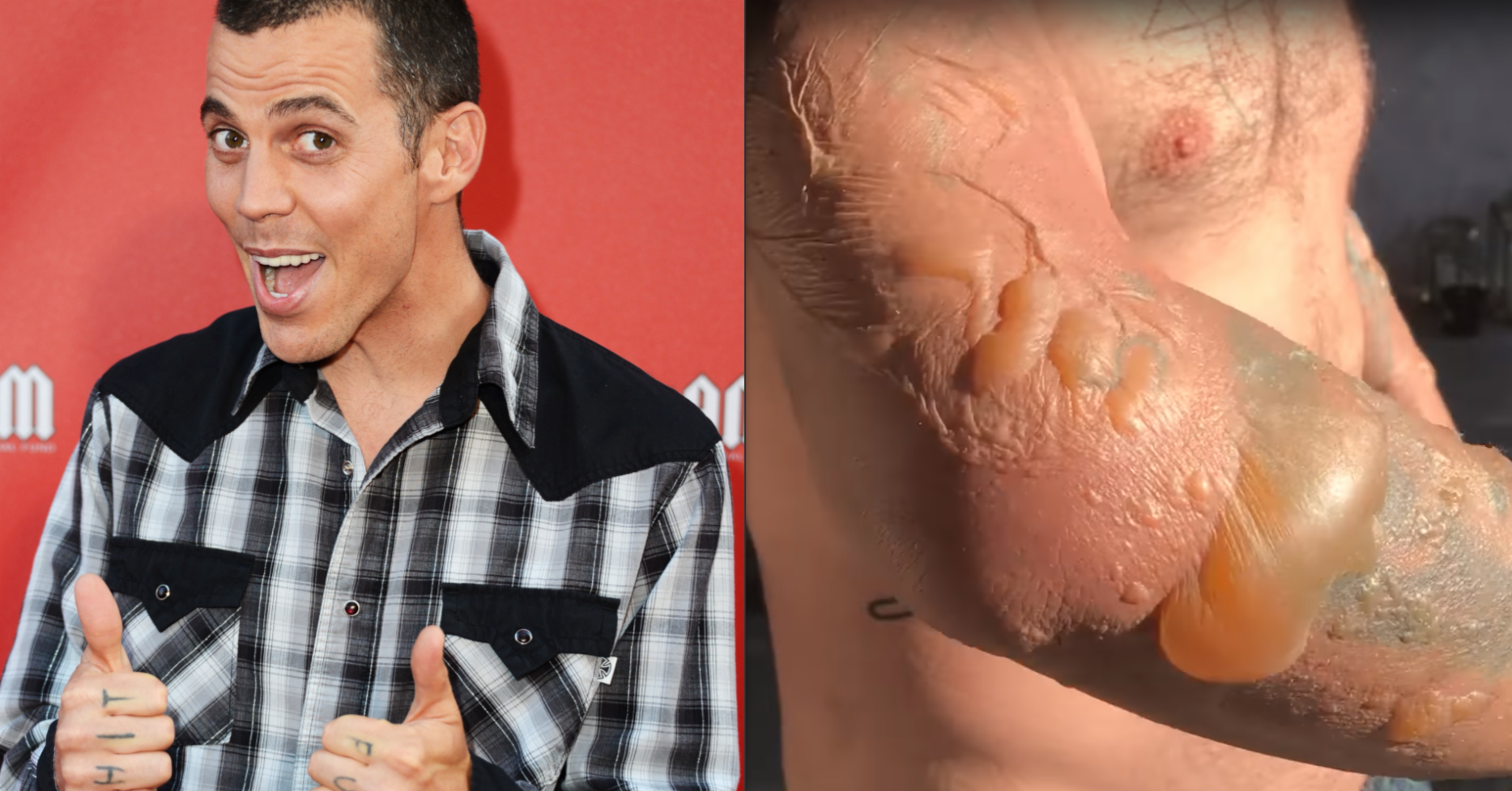 Steve O Burn