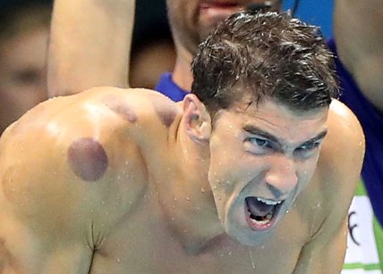 Michael Phelps AP cupping