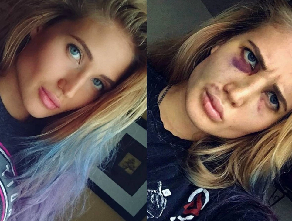 Screenshot (175).png anastasia yankova before after