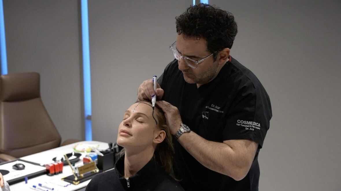 Why Turkey Has Become A Global Destination For Hair Restoration